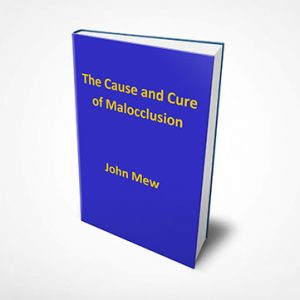 The Cause and Cure of Malocclusion Book, John Mew